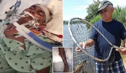 Đi bắt cua, người đàn ông không ngờ mắc phải loại khuẩn gây 'rụng' cả tay lẫn chân