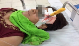 Người phụ nữ may mắn thoát chết khi bị dao đâm xuyên não 6cm
