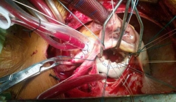 Hà Nội: Vỡ tim khi đang đi ô tô, người đàn ông được bác sĩ BV Việt Đức cứu sống