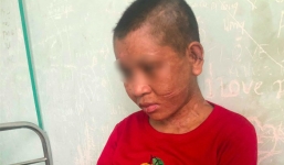 Con gái làm thuê bị tra tấn đến biến dạng, mẹ đẻ không nhận ra