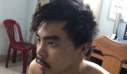 Đôi nam nữ chống trả quyết liệt tên cướp giật điện thoại giữa Sài Gòn