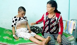 Vụ án người giúp việc bị chủ tra tấn: Sẽ khởi tố nếu kết quả giám định thương tật đủ 11\%