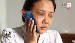 Cô gái bị người yêu 7 năm dùng mũ bảo hiểm đánh bầm dập lên tiếng, kẻ bạo hành đã bị bắt để thẩm vấn