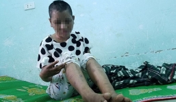 Vụ tra tấn người làm thuê như thời trung cổ: Bộ trưởng LĐTB&XH đề nghị khởi tố vụ án