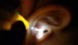 Thiếu nữ bị gián chui vào tai, cắn thủng màng nhĩ khiến nhiều người sợ hãi