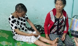 Vụ cô gái bị tra tấn như thời trung cổ: Lời kể kinh hoàng của người trong cuộc