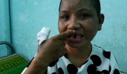 Bà chủ có triệu chứng ngáo đá, bạo hành người giúp việc dã man như thời trung cổ gây bức xúc trong dư luận