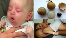 Bé gái Nam Định sống thực vật vì vừa đùa vừa ăn nhãn, BV Nhi trung ương không thể chữa trị