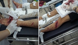 Nhóm côn đồ đất Cảng hàng chục người chém trọng thương một chủ đầm thủy sản