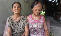 Bà nội bé gái bị tạt axit năm 7 tuổi vì mẹ 'giật chồng' người khác đã đến TP.HCM để xin đôi mắt tử tù cứu cháu