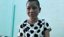 Vụ bạo hành người làm ở Gia Lai: Nạn nhân về quê điều trị, chưa rõ tỷ lệ thương tật