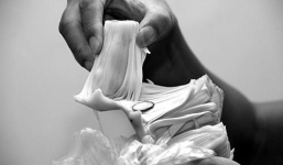 Mổ cấp cứu bệnh nhân ăn quá nhiều mít dẫn đến tắc ruột