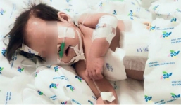 Hy hữu gé 10 tháng tuổi mang trong người 2 siêu vi khuẩn kháng tất cả kháng sinh