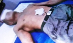 Yêu chung một người, U70 mua axit tấn công tình địch