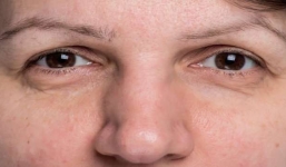 7 dấu hiệu chứng tỏ bạn không những 'già trước tuổi' mà còn đang có bệnh