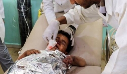 Xe buýt chở học sinh đi dự trại hè trúng không kích, 104 người thương vong