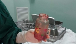 Người đàn ông dùng bình sữa nhét vào hậu môn để chữa thoái hóa cột sống