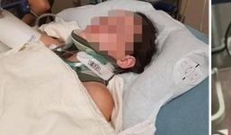 Bị bạn đẩy từ độ cao 18m xuống nước, cô gái suýt mất mạng