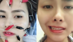 Tâm sự của cô gái xinh đẹp bị... méo mồm chỉ vì cái điều hòa nhiệt độ