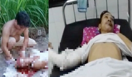 2 người bị nhóm côn đồ chém trọng thương trên đường đi làm