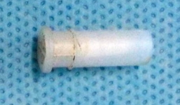 Hy hữu: Thở ra tiếng sáo, ai dè cậu bé mắc kẹt còi trong cổ họng