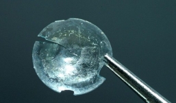 Người phụ nữ bị sụp mí vĩnh viễn vì kính áp tròng mắc kẹt trong mắt suốt 28 năm