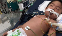 Hà Nội: Bé trai 7 tuổi đang khoẻ mạnh bỗng hôn mê vì suy đa tạng, nhiễm trùng máu sau trận sốt cao