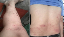 Sau khi trả lời phóng sự điều tra của VTV9, người đàn ông bị nhóm côn đồ hành hung