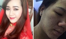 9X xinh đẹp biến đổi 180 độ khi mang bầu, không hối tiếc vì đánh đổi cả thanh xuân để sinh con