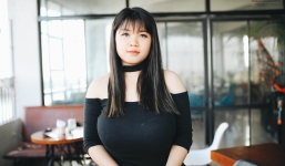 Cô gái với vòng 1 'khủng' lên đến 110cm đã làm phẫu thuật thu nhỏ ngực