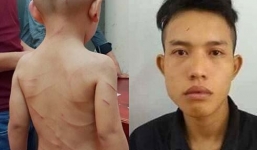 Đã có kết luận vụ cha dượng đánh dã man bé 3 tuổi ở Phú Quốc