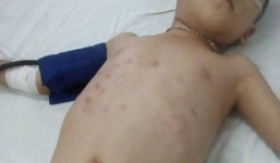 Vụ bạo hành con riêng 5 tuổi của người tình: Mẹ nạn nhân lên tiếng