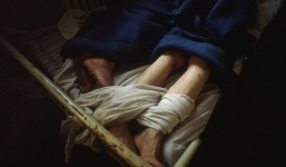 Những tấm hình ám ảnh trong bệnh viện tâm thần 50 năm trước