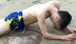 Đau đớn tột cùng: Đang bơi ngoài biển, thanh niên bất ngờ bị cá đuối chích vào vùng kín