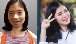 Cô gái bị gắn mác 'ma cà rồng', suốt 18 năm không dám soi gương và hành trình 'lột xác' khiến nhiều người ngỡ ngàng