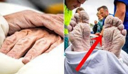 Rùng mình khi nhìn cơ thể chàng trai sau 55 tiếng đồng hồ bơi 163 km, nhưng mục đích phía sau mới thật sự khiến mọi người rơi nước mắt