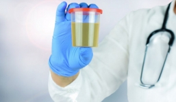 10 bí mật về nước tiểu liên quan đến thận, sức khỏe: Ai cũng nên biết rõ để phòng bệnh tốt