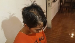 Thiếu nữ 14 tuổi bị nhóm thanh niên truy sát giữa đêm ở Sài Gòn