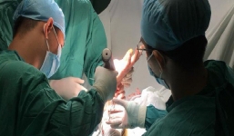 Nối bàn tay đứt lìa cho thanh niên 20 tuổi bị chém khi đưa người đi cấp cứu