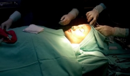 Nhan sắc hiện tại của những sao Việt công khai “đập đi xây lại”: Người được khen ngợi, kẻ gây sốc vì gương mặt biến dạng