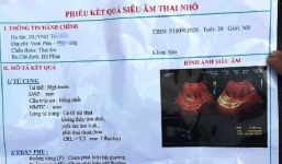 Vụ chẩn đoán sai khiến thai phụ suýt mất con: Lãnh đạo bệnh viện nói gì?