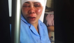 Người chồng vũ phu đưa vợ lên đồi hành hung dã man vì ghen tuông