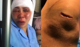 Bắt tạm giam, khởi tố người chồng đưa vợ lên đồi vắng bạo hành dã man