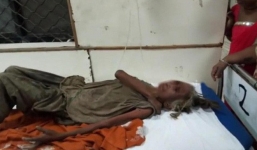 Anh ruột nhẫn tâm hành hạ và bỏ đói em gái đến 'thân tàn ma dại', chỉ cho ăn một lát bánh mì mỗi 4 ngày trong suốt 2 năm