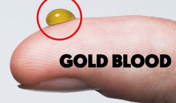 Kinh ngạc với nhóm máu được ví với 'vàng ròng', và chỉ 43 người trên thế giới có nó