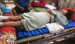 Bị bỏng nặng, da thịt thối rữa, người phụ nữ bị tê liệt chân tay vẫn phải cắn răng chịu đựng vì không đủ tiền nhập viện