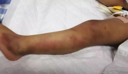 Ly dị được 6 tháng, người đàn ông tá hóa nhận tin con gái qua đời, không ngờ kẻ gián tiếp gây ra cái chết lại chính là vợ cũ