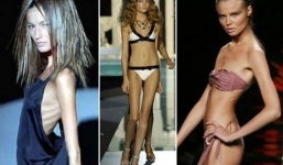 Mặt trái đáng sợ của ngành người mẫu: bị lạm dụng tình dục, những căn bệnh nghề nghiệp, ăn bông gòn ép cân và nhiều cái chết đau đớn