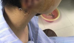 Nam sinh nghi ngáo đá cắn đứt tai bạn học