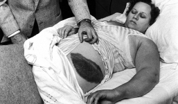 Bà cô xui xẻo nhất lịch sử: Đang ngủ bị thiên thạch rơi trúng người, kiện tụng tốn kém để rồi mất cả tiền lẫn chồng